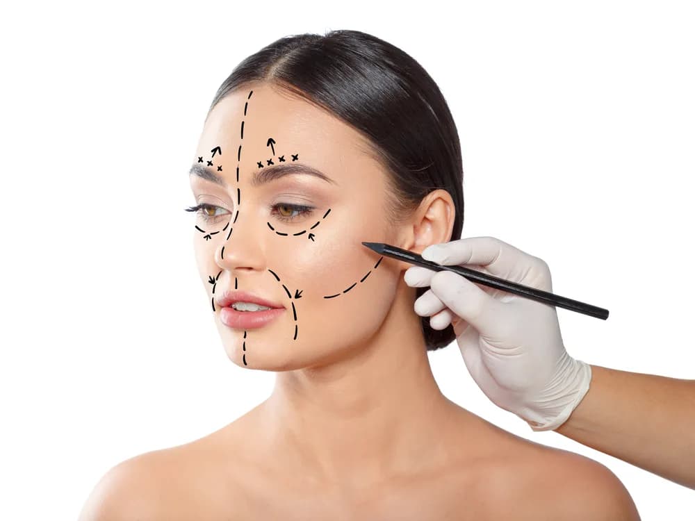 Facelift (üz cavanlaşdırma)