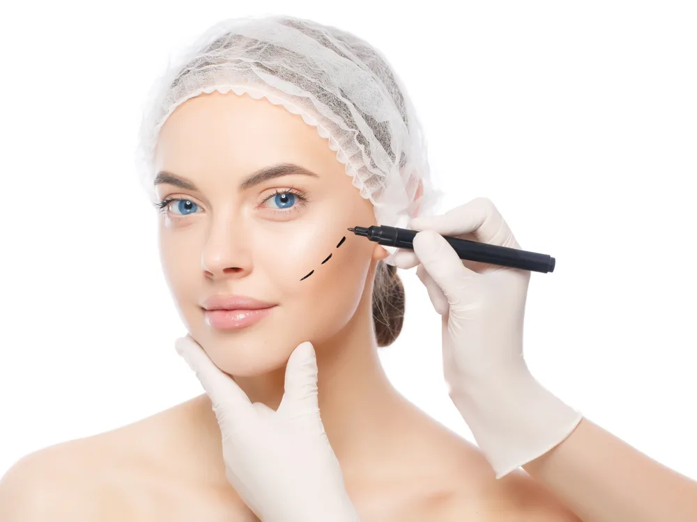 Facelift (üz cavanlaşdırma)