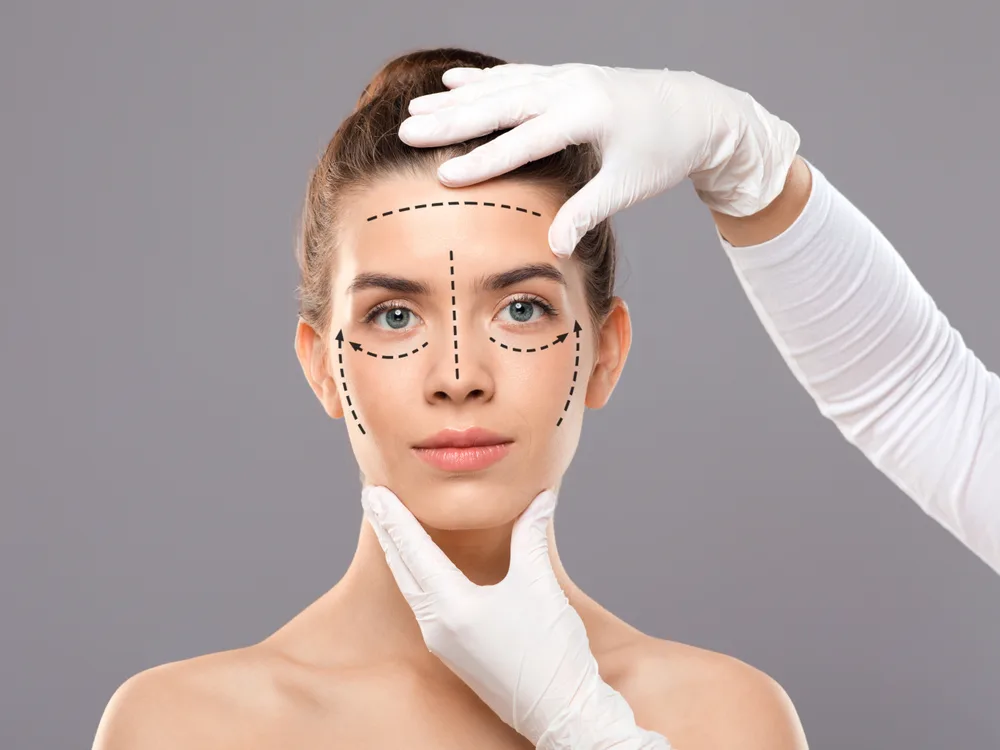 Facelift (üz cavanlaşdırma)