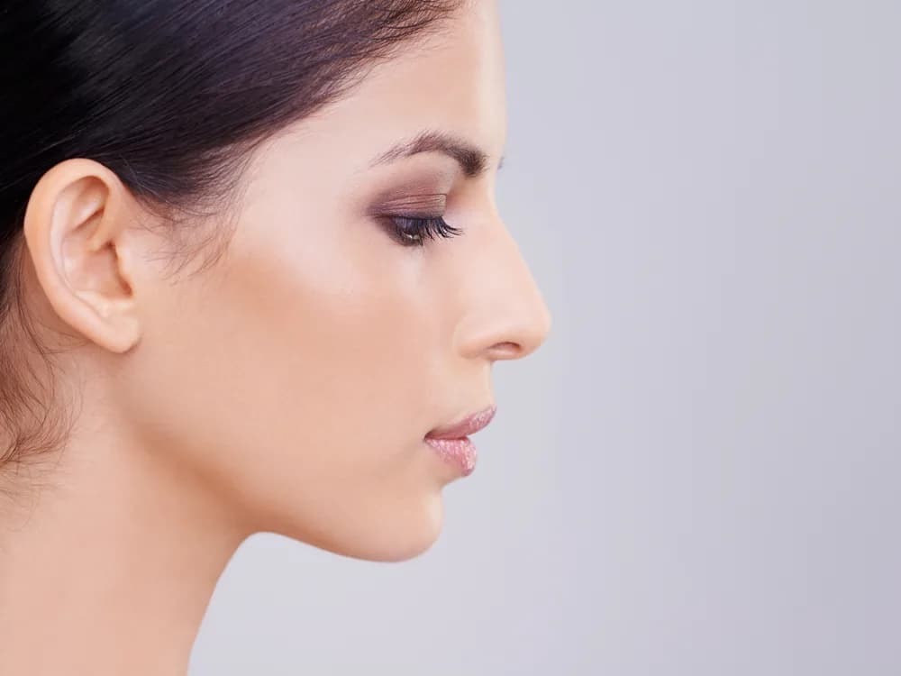 Rinoplastika
